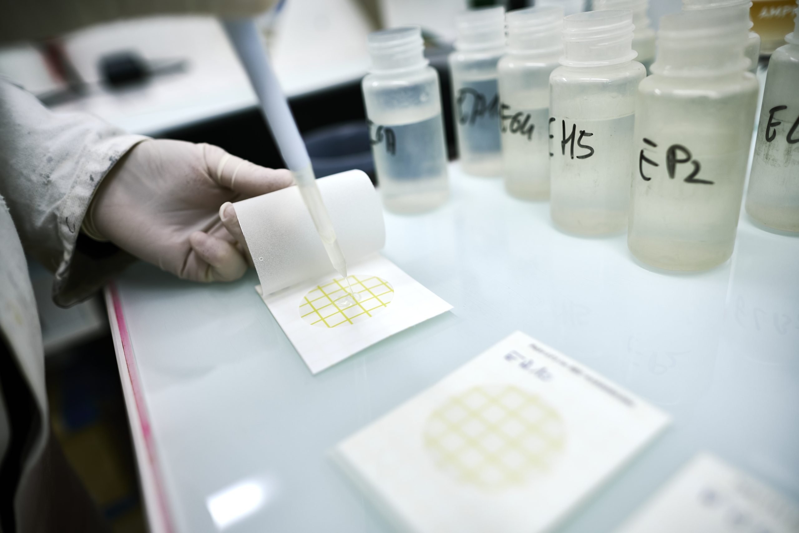 Analyses laboratoire 